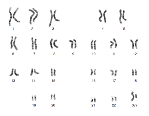 https://scwai.wordpress.com/2011/04/22/human-chromosomes/