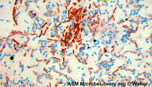 http://microbeonline.com/wp-content/uploads/2015/05/bacillus-cereus_endospore-stain_fig13jpg