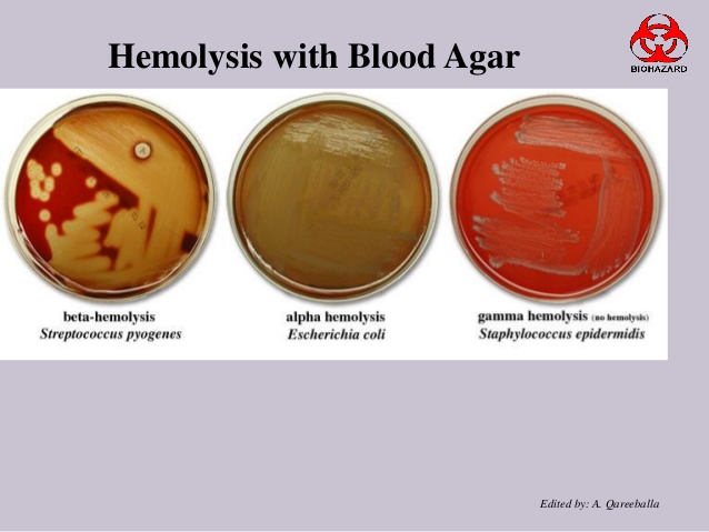 Agar Definition and Examples - Biology Online Dictionary