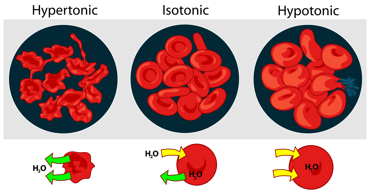 What happens to red blood cells placed into salt water? | Socratic