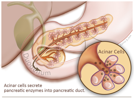 pathology.jhu.edu/pancreas/images/figure4.jpg