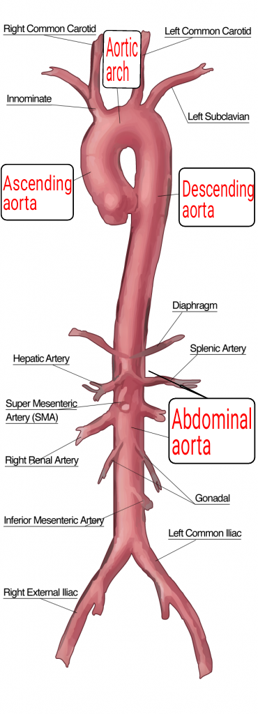 http://www.examrefresh.com/abdominal-aorta-ivc/