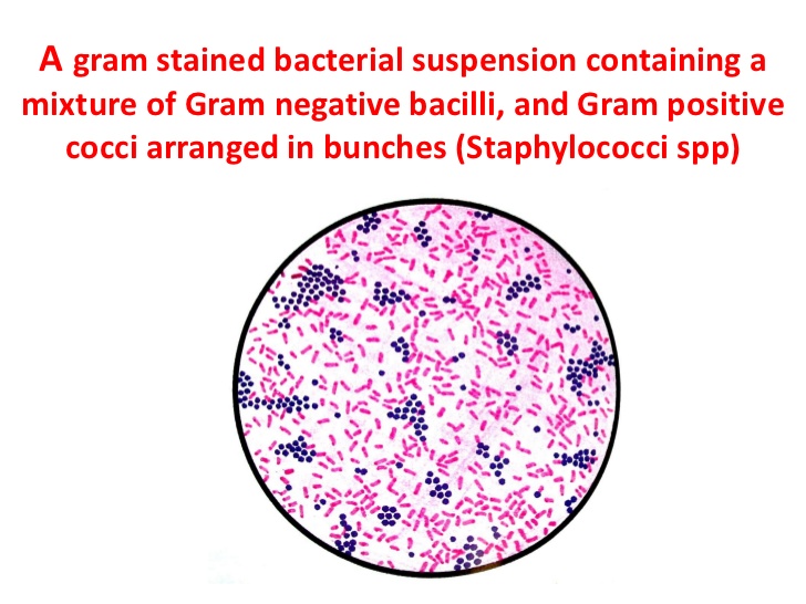 characteristics of gram negative bacteria