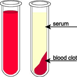 http://www.differencebetween.info/difference-between-plasma-and-serum