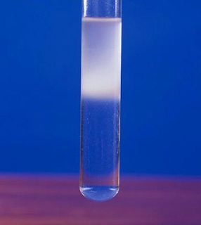 http://biology-igcse.weebly.com/-food-test-3---emulsion-ethanol-test-for-fats.html