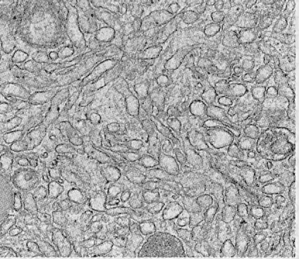 Electron micrograph section of Smooth Endoplasmic - ref 2.