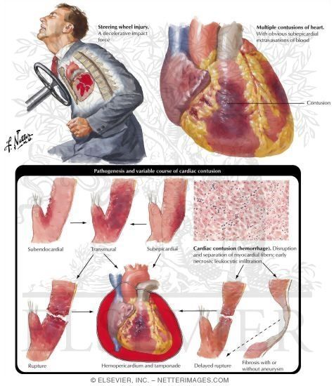 From Anything Anatomy, on Pinterest