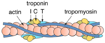 https://drsvenkatesan.com/2009/05/07/how-good-is-troponin-t-to-rule-out-acute-coronary-syndrme-in-the-emergency-room/04_16/