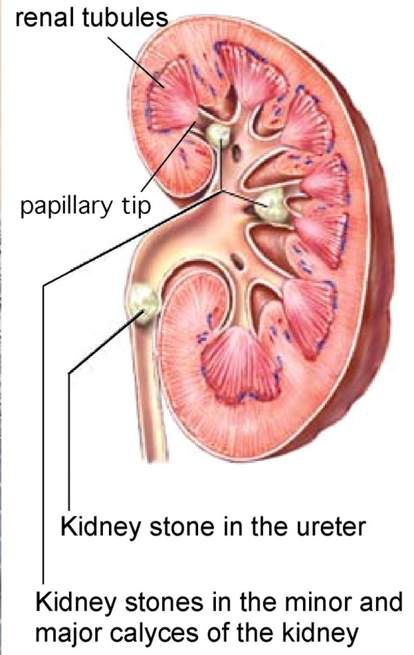http://kidneypictures.org/image/5/Kidney-Pictures-5jpg