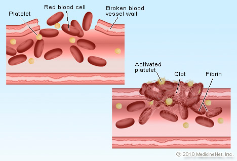 https://www.medicinenet.com/image-collection/blood_clot_picture/picture.htm