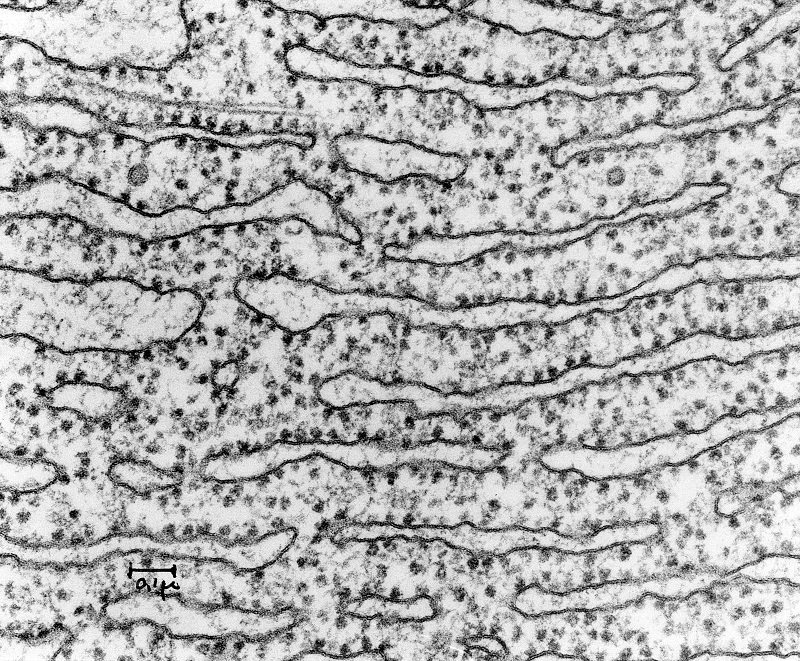 Electron micrograph section of Rough Endoplasmic - ref 1.