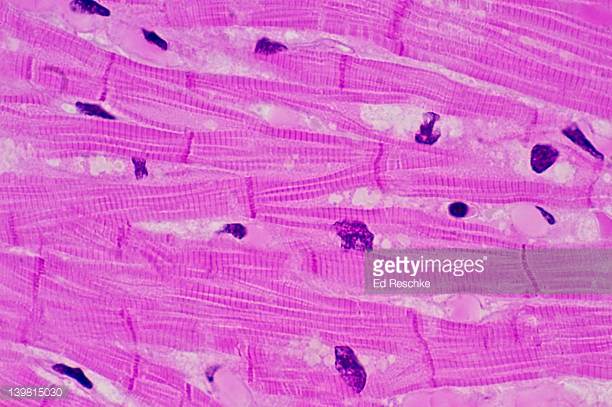 http://www.gettyimages.com/detail/photo/cardiac-muscle-with-intercalated-discs-high-res-stock-photography/139815030